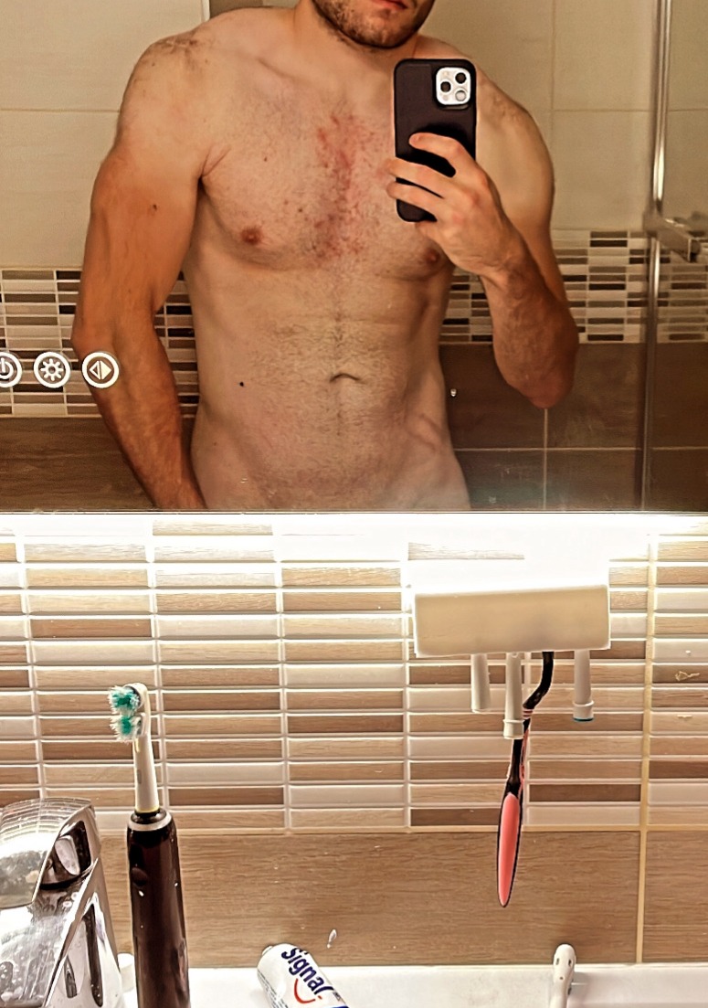 Profilo di Hippolite